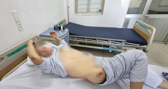 Nh&oacute;m xăm trổ, đội mũ cối d&ugrave;ng hung kh&iacute; uy hiếp, h&agrave;nh hung cưỡng chế chủ đầm t&ocirc;m - Ảnh 3.