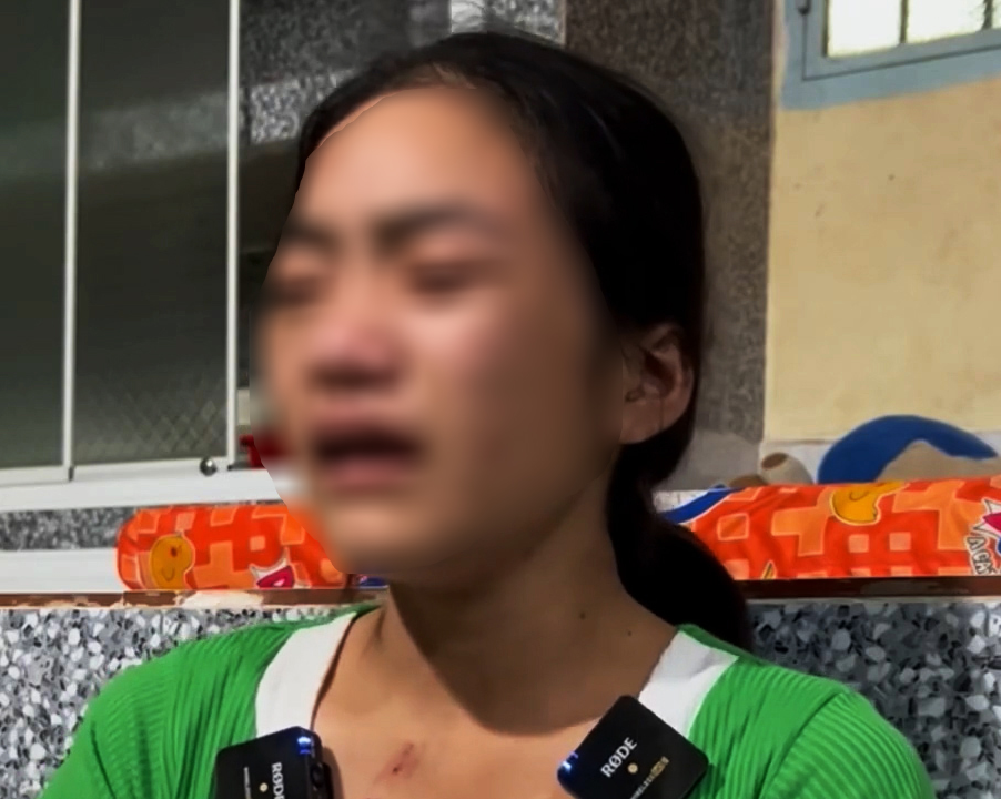 Vụ thiếu nữ bị đánh đập dã man, bắt ăn thằn lằn sống: Người mẹ nói gì?