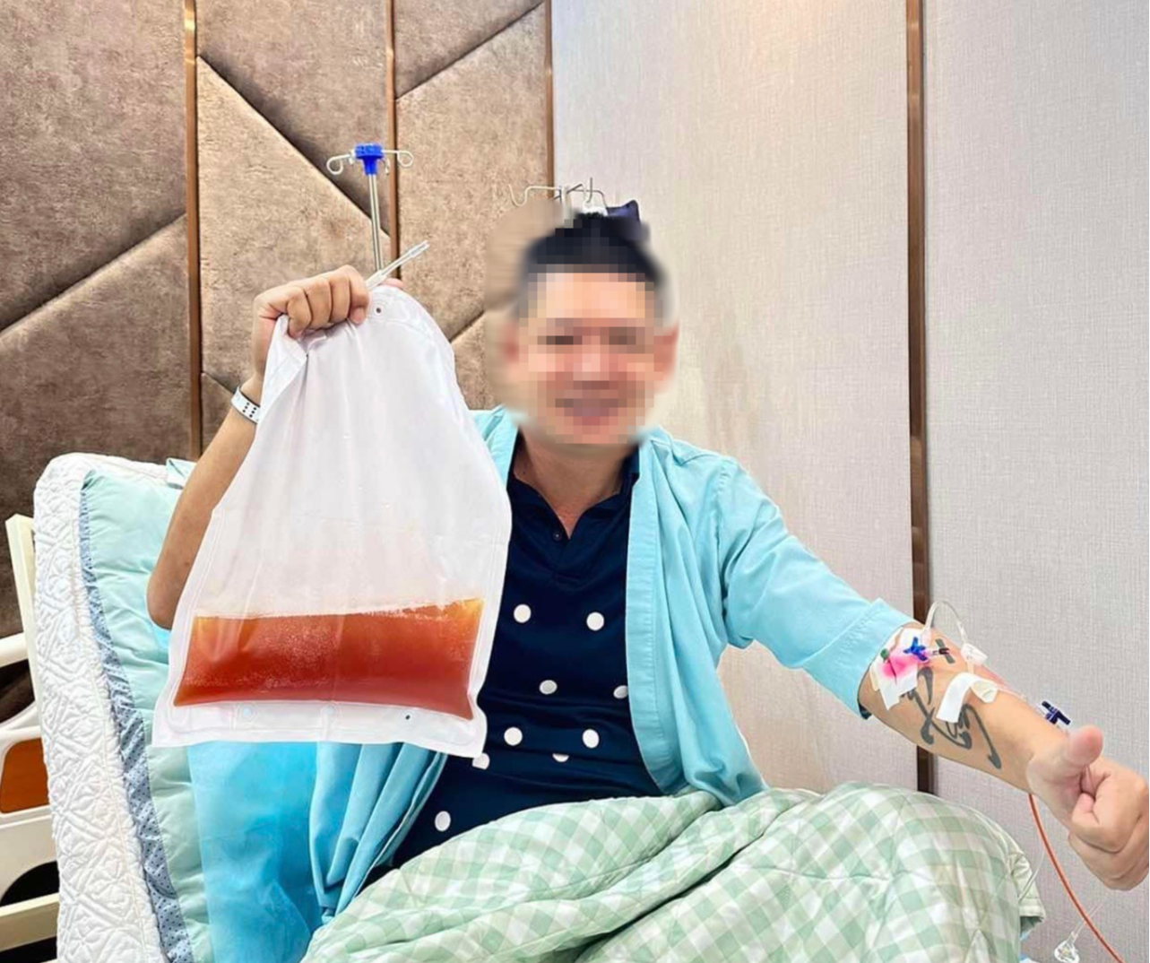 Có hay không phương pháp lọc mỡ máu tốt cho sức khỏe?