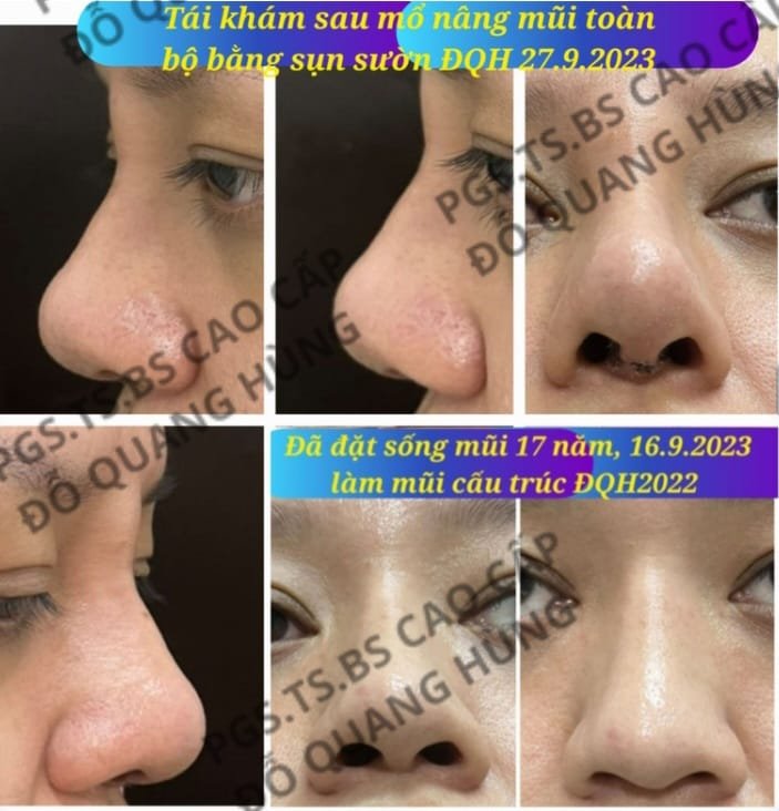 Nhiều kỹ thuật mới, độc đáo cứu người- Ảnh 9.