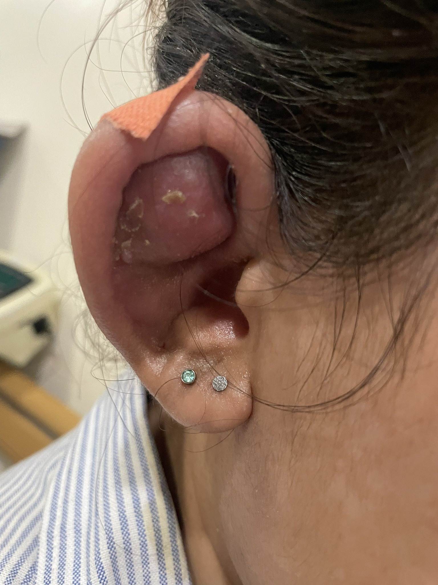 Thiếu nữ tai biến thành "Trư Bát Giới" sau làm đẹp- Ảnh 1.