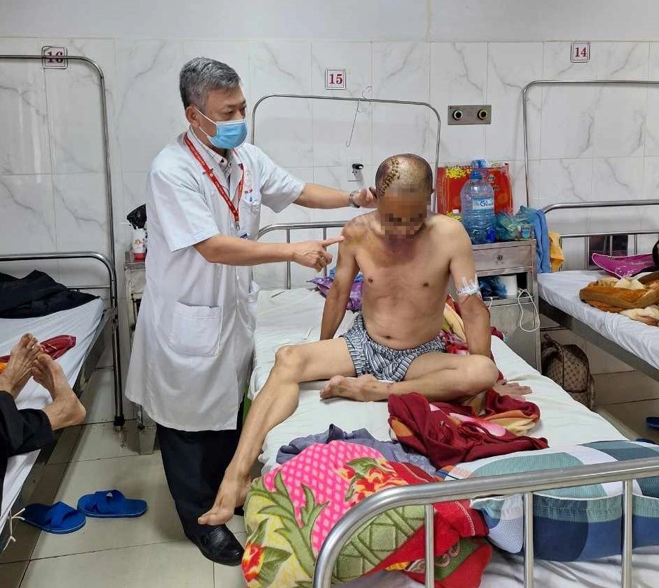 Bắt giữ thanh niên say xỉn đánh người chấn thương sọ não- Ảnh 1.