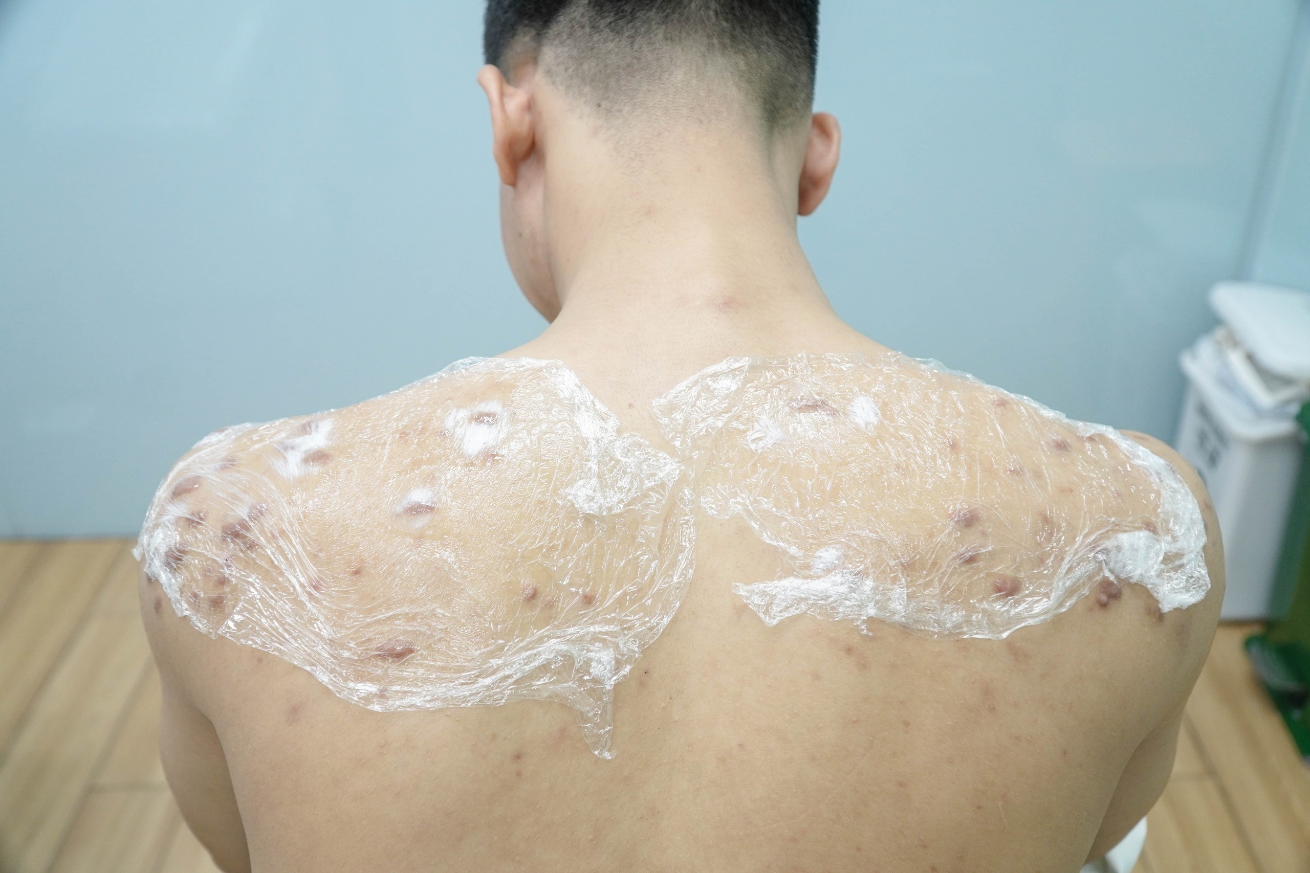 Nam giới chi mạnh tay để n&acirc;ng cấp nhan sắc- Ảnh 1.