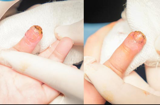 Kẹp tay vào cửa kính thủy lực ở siêu thị, bé 3 tuổi bị đứt ngón tay- Ảnh 3.