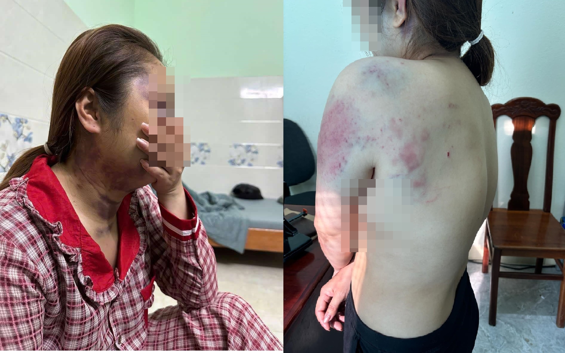 Điều tra việc người phụ nữ bị "chồng hờ" nhốt, bạo hành liên tục 13 giờ