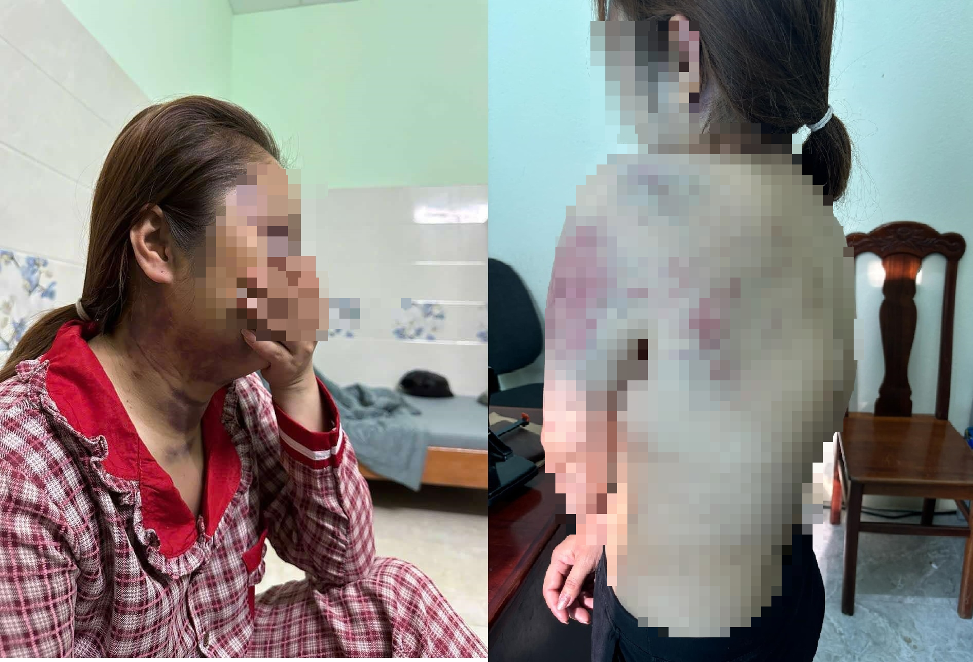 Điều tra việc người phụ nữ bị "chồng hờ" nhốt, bạo h&agrave;nh li&ecirc;n tục 13 giờ- Ảnh 1.