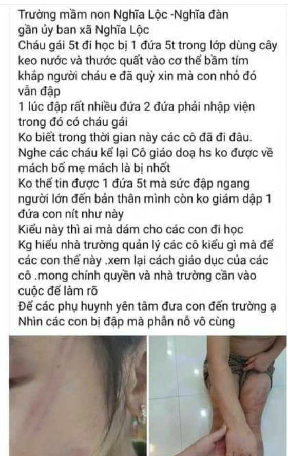 Vụ nhiều học sinh mầm non bị đánh bầm tím: Đánh các bạn là bé gái 5 tuổi - Ảnh 1.