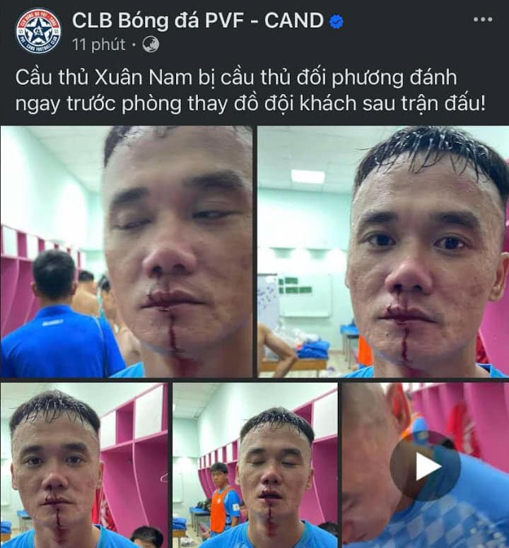 V&igrave; sao Xu&acirc;n Nam v&agrave; Văn Sơn x&ocirc; x&aacute;t sau trận đấu?- Ảnh 1.