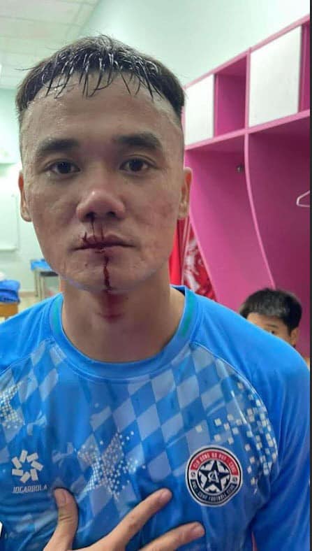 V&igrave; sao Xu&acirc;n Nam v&agrave; Văn Sơn x&ocirc; x&aacute;t sau trận đấu?- Ảnh 2.