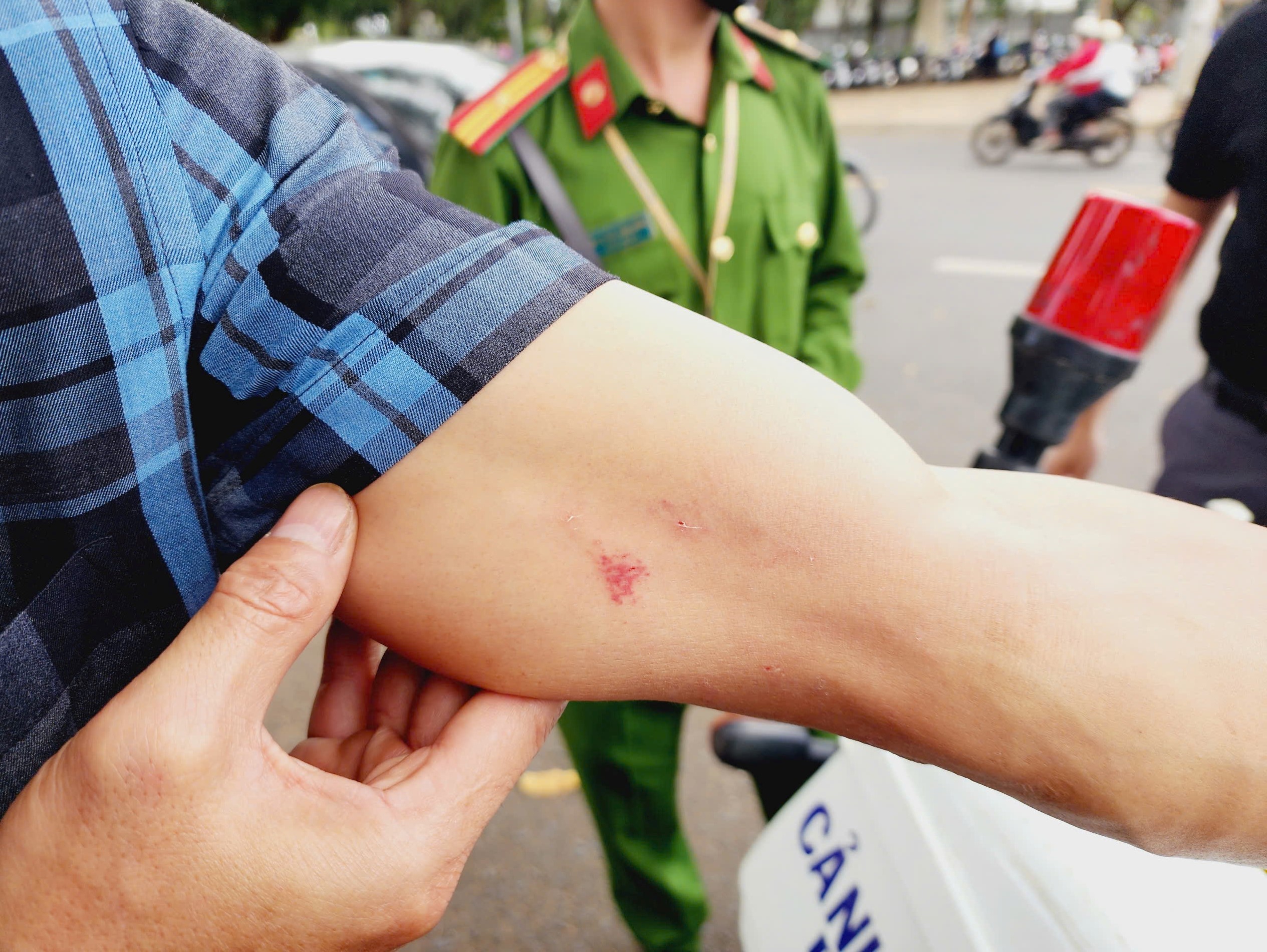 T&aacute;c nghiệp tại c&ocirc;ng tr&igrave;nh bỏ hoang, 1 ph&oacute;ng vi&ecirc;n B&aacute;o C&ocirc;ng an Nh&acirc;n d&acirc;n tố bị h&agrave;nh hung- Ảnh 1.
