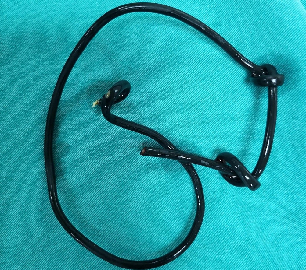 Nam thanh niên bị mắc kẹt đồ chơi tình dục dài 23 cm- Ảnh 2.