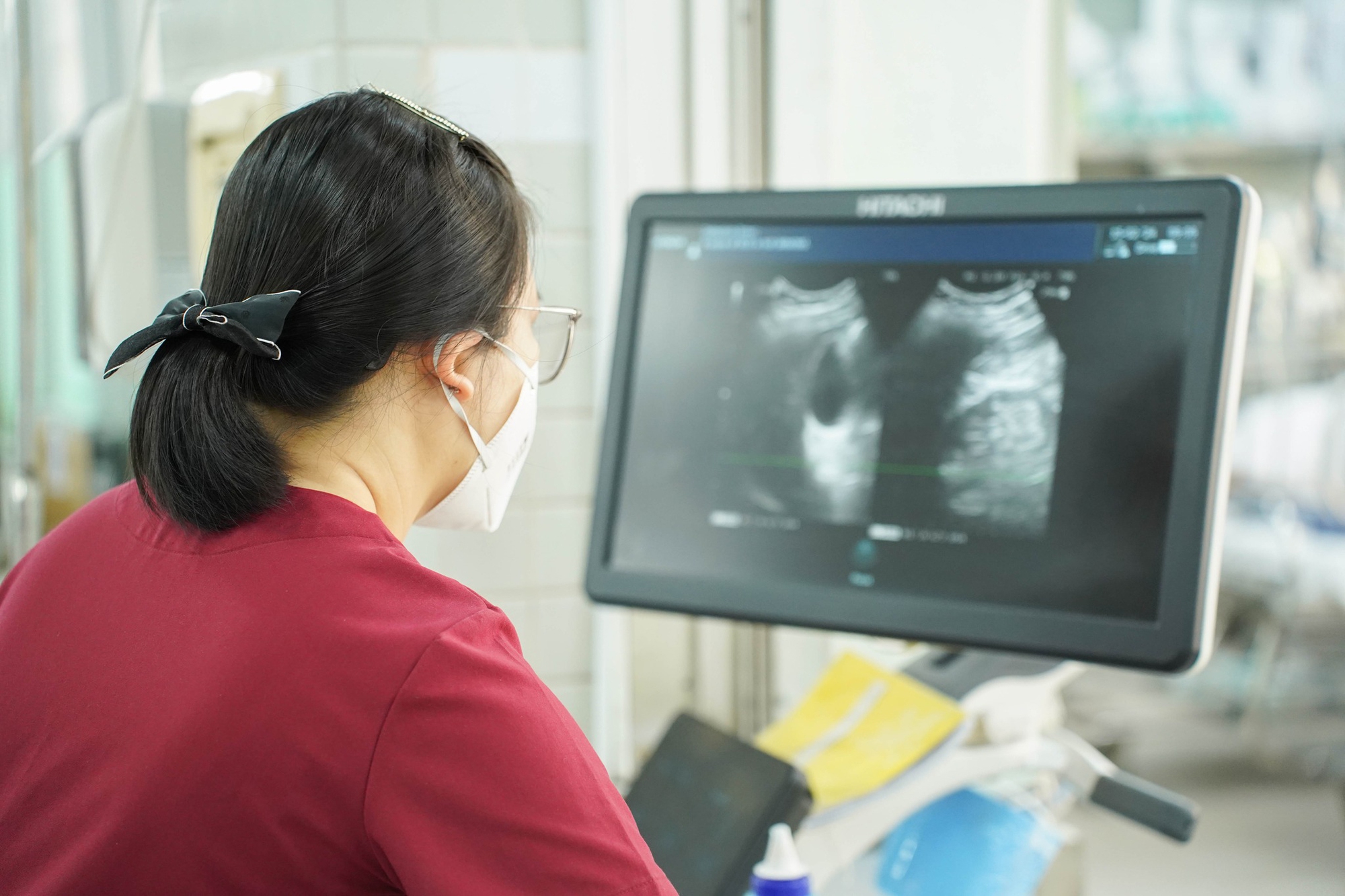Số ca nhập viện do tai nạn giao thông giảm nhiều- Ảnh 1.