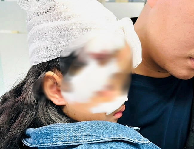 Nhiều trẻ bị chó cắn rất thương tâm- Ảnh 2.