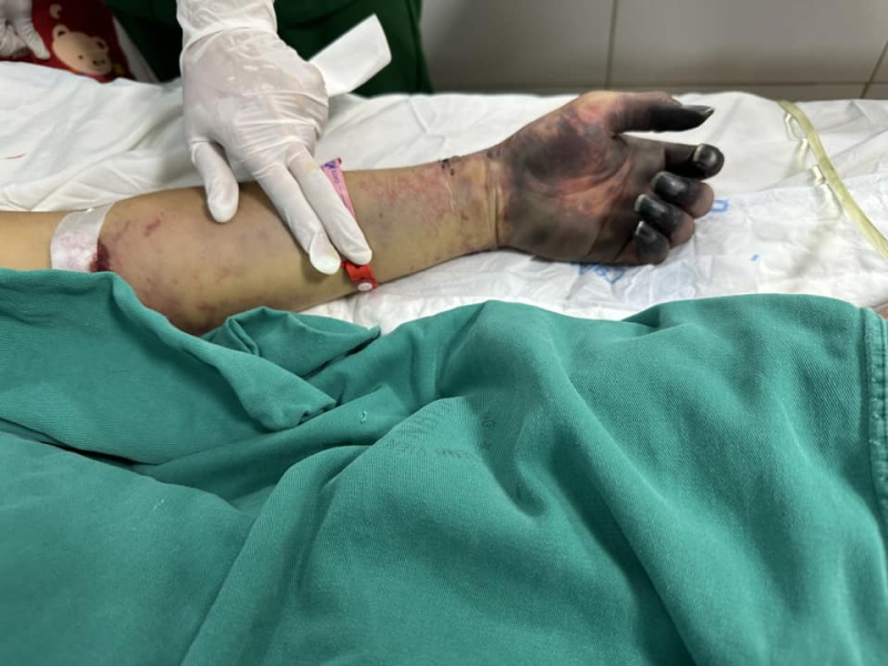 Nam bảo vệ nguy kịch do nhiễm vi khuẩn trong