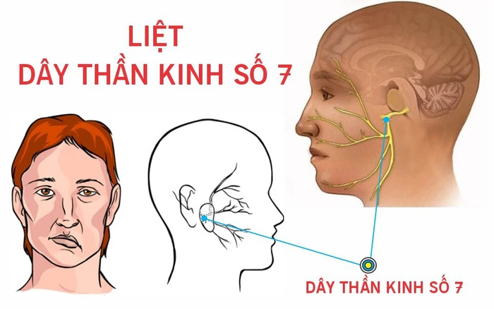 Căn bệnh khiến ca sĩ Nguyễn Trần Trung Quân vào bệnh viện cấp cứu- Ảnh 1.