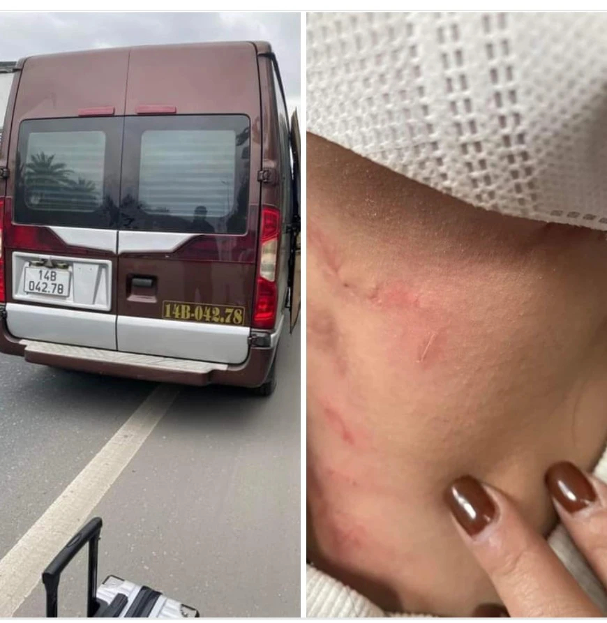 Thiếu tướng Đinh Văn Nơi chỉ đạo điều tra vụ hành khách