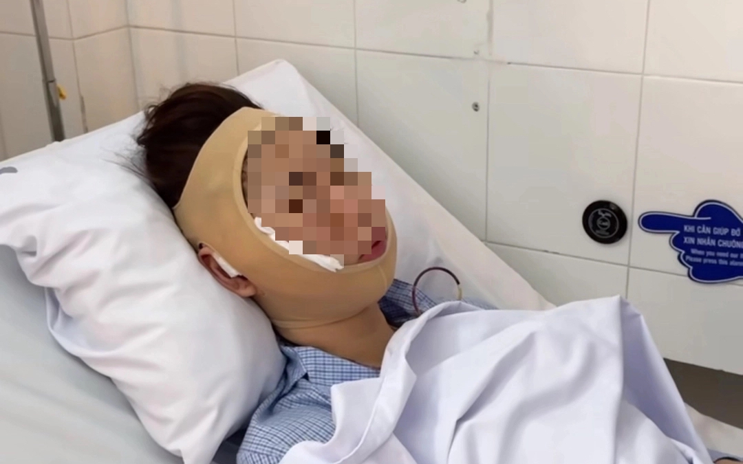 Nữ TikToker nổi tiếng đưa ra lời cảnh báo sau 6 năm "tiêm filler"