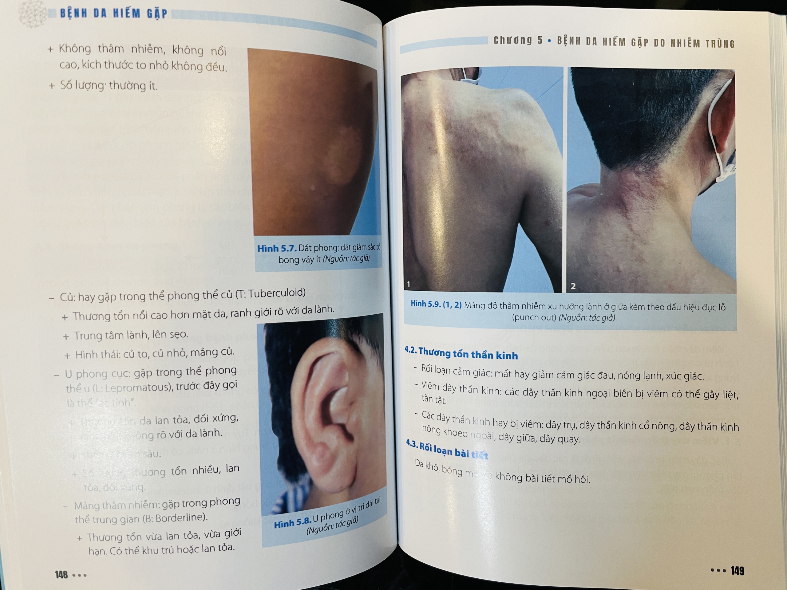  C&ocirc;ng bố gần 50 bệnh da hiếm gặp- Ảnh 1.