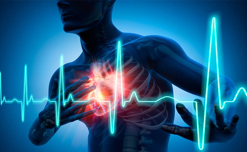 Phương ph&aacute;p mới: Biết trước cơn nhồi m&aacute;u cơ tim tận 6 th&aacute;ng- Ảnh 1.