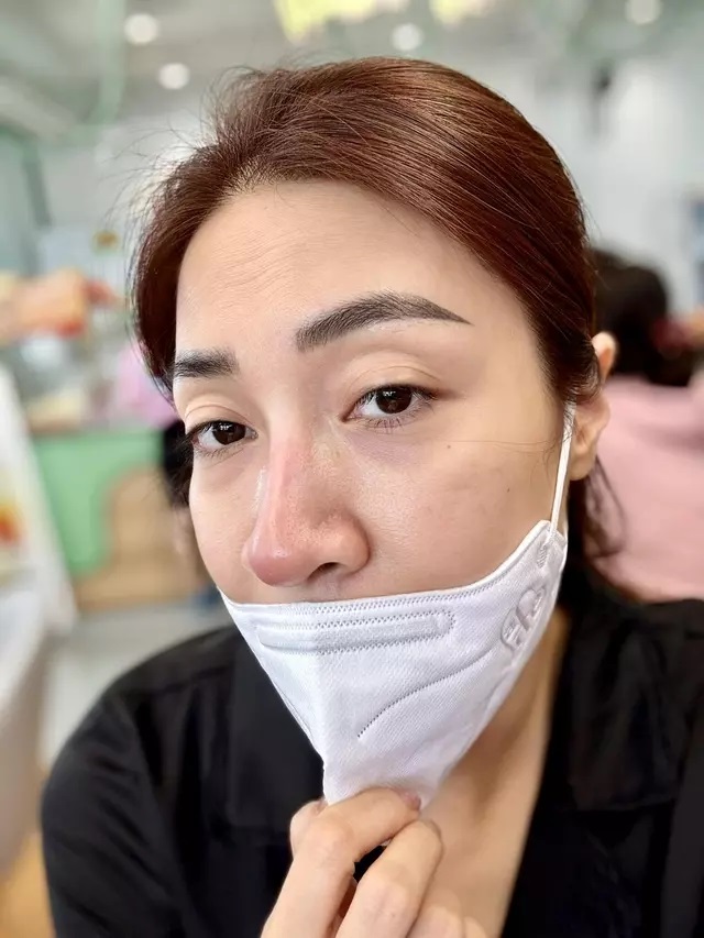 Ca sĩ Pha Lê bị biến chứng nặng sau 12 năm