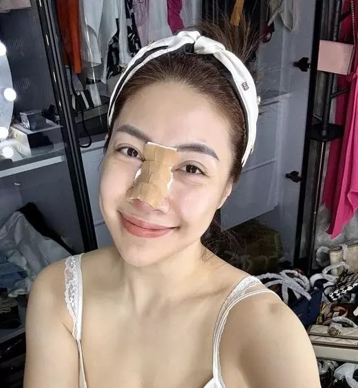 Ca sĩ Pha Lê bị biến chứng nặng sau 12 năm