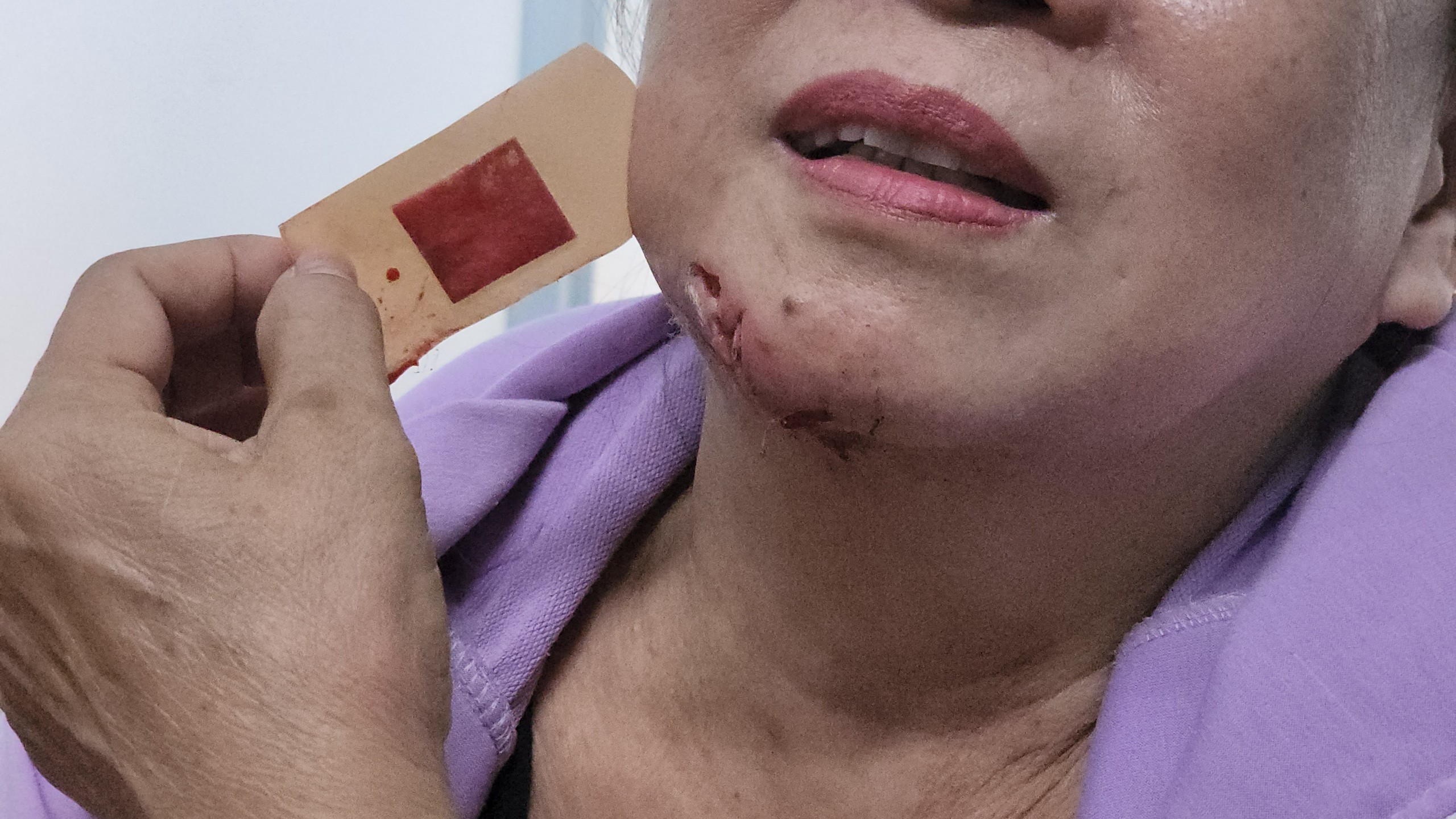 TP HCM phát văn bản khẩn phòng, chống bệnh dại- Ảnh 3.