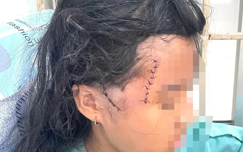 Mẹ và con gái bị người tình chém thương tích nhập viện
