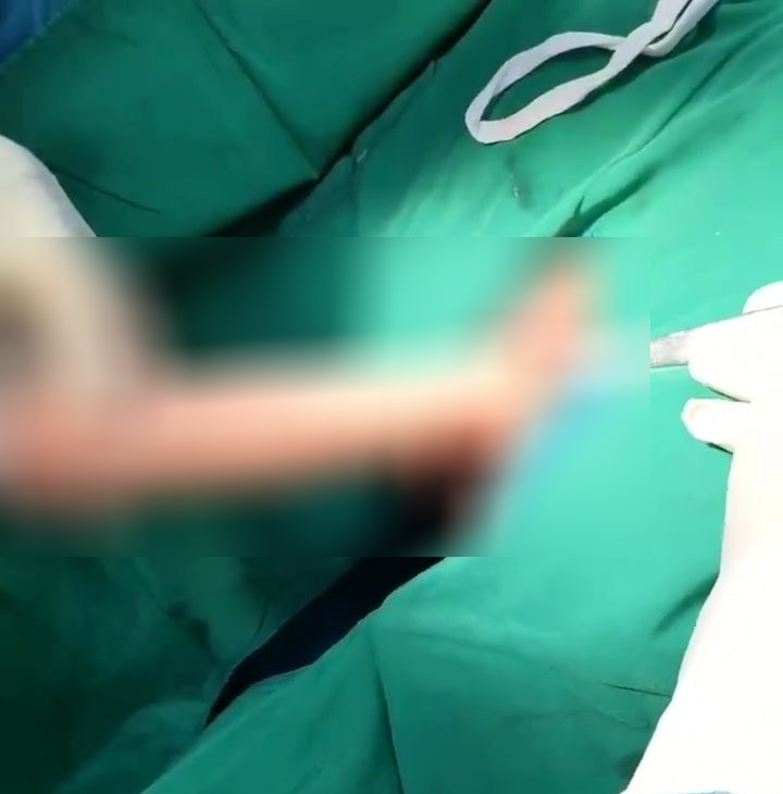 Dương vật giả mắc kẹt trong trực tràng nam thanh niên 23 tuổi- Ảnh 1.
