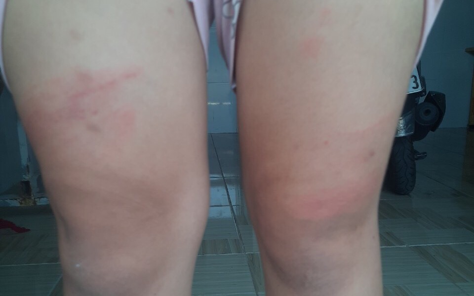 Đánh đập con riêng của người yêu, cô gái ở BR-VT bị xử phạt