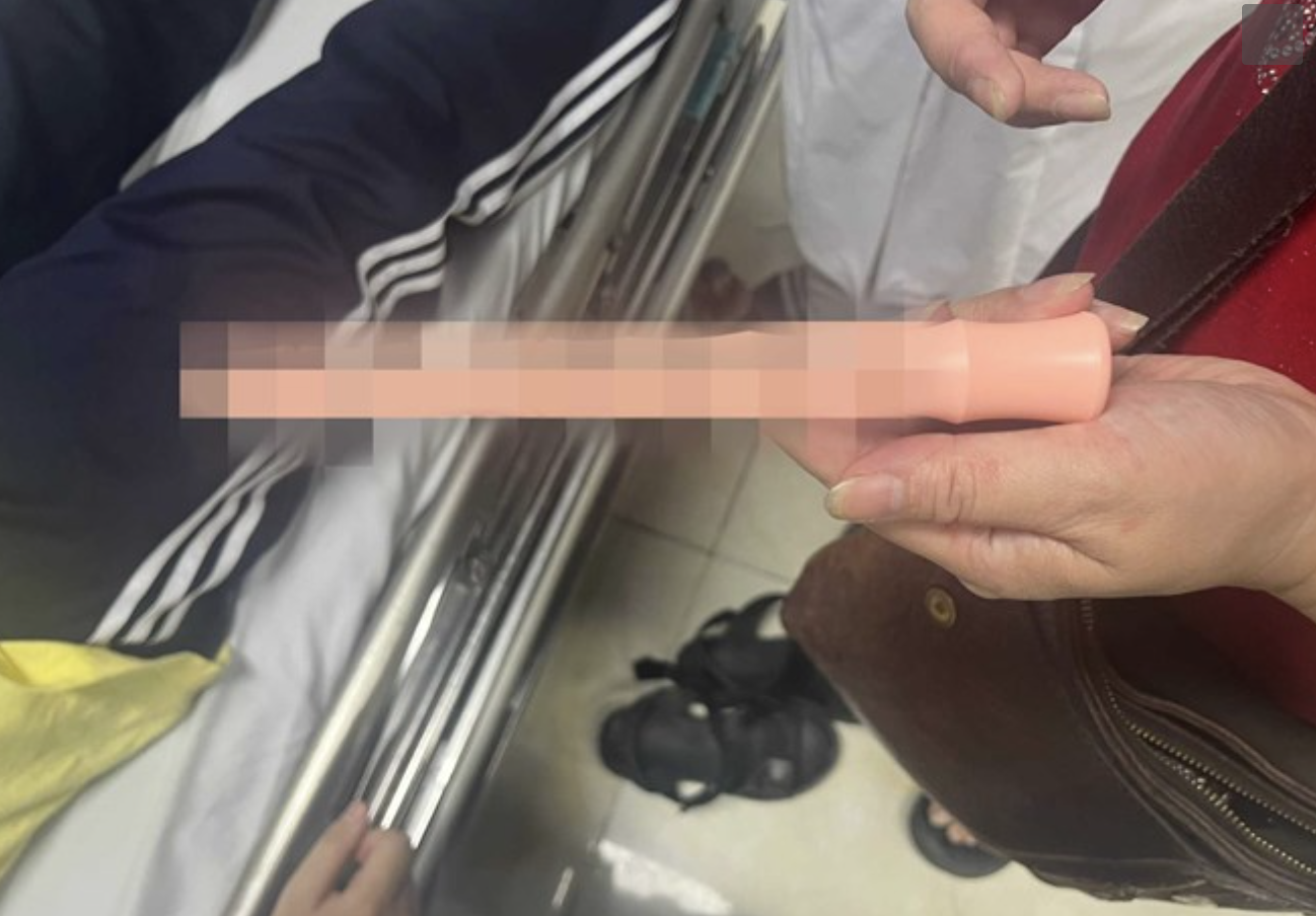 Nam sinh cấp cứu v&igrave; đồ chơi t&igrave;nh dục mắc kẹt trong hậu m&ocirc;n- Ảnh 1.
