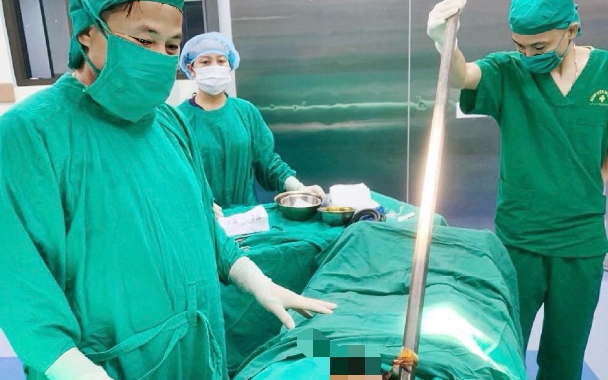 Thanh xà beng dài 1 m đâm xuyên bụng người đàn ông