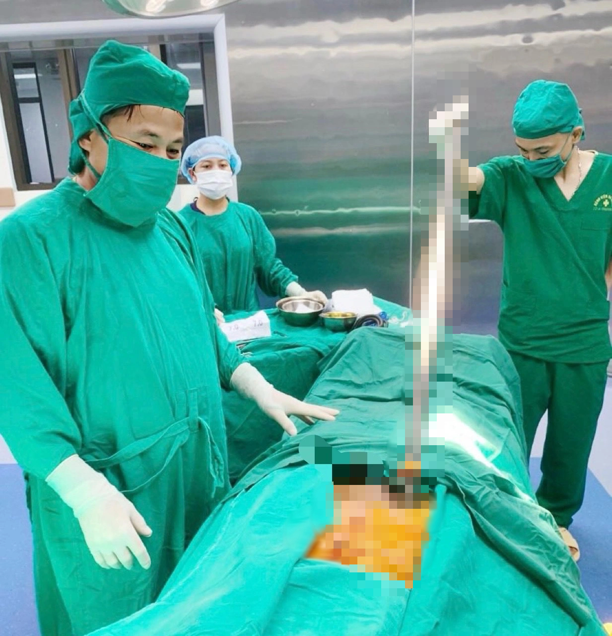 Thanh x&agrave; beng d&agrave;i 1 m đ&acirc;m xuy&ecirc;n bụng người đ&agrave;n &ocirc;ng- Ảnh 1.