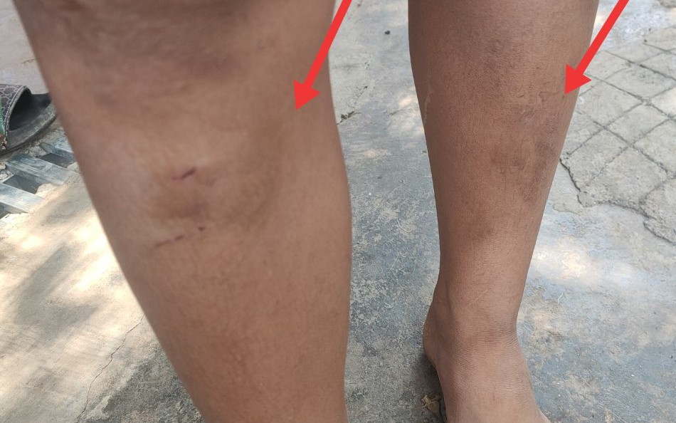 5 ch&aacute;u nhỏ bị h&agrave;ng x&oacute;m đ&aacute;nh bầm dập, bắt quỳ giữa đường