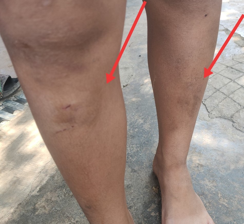 Vụ 5 ch&aacute;u nhỏ bị h&agrave;ng x&oacute;m đ&aacute;nh bầm dập: Chuyển hồ sơ l&ecirc;n C&ocirc;ng an TP Bu&ocirc;n Ma Thuột- Ảnh 1.