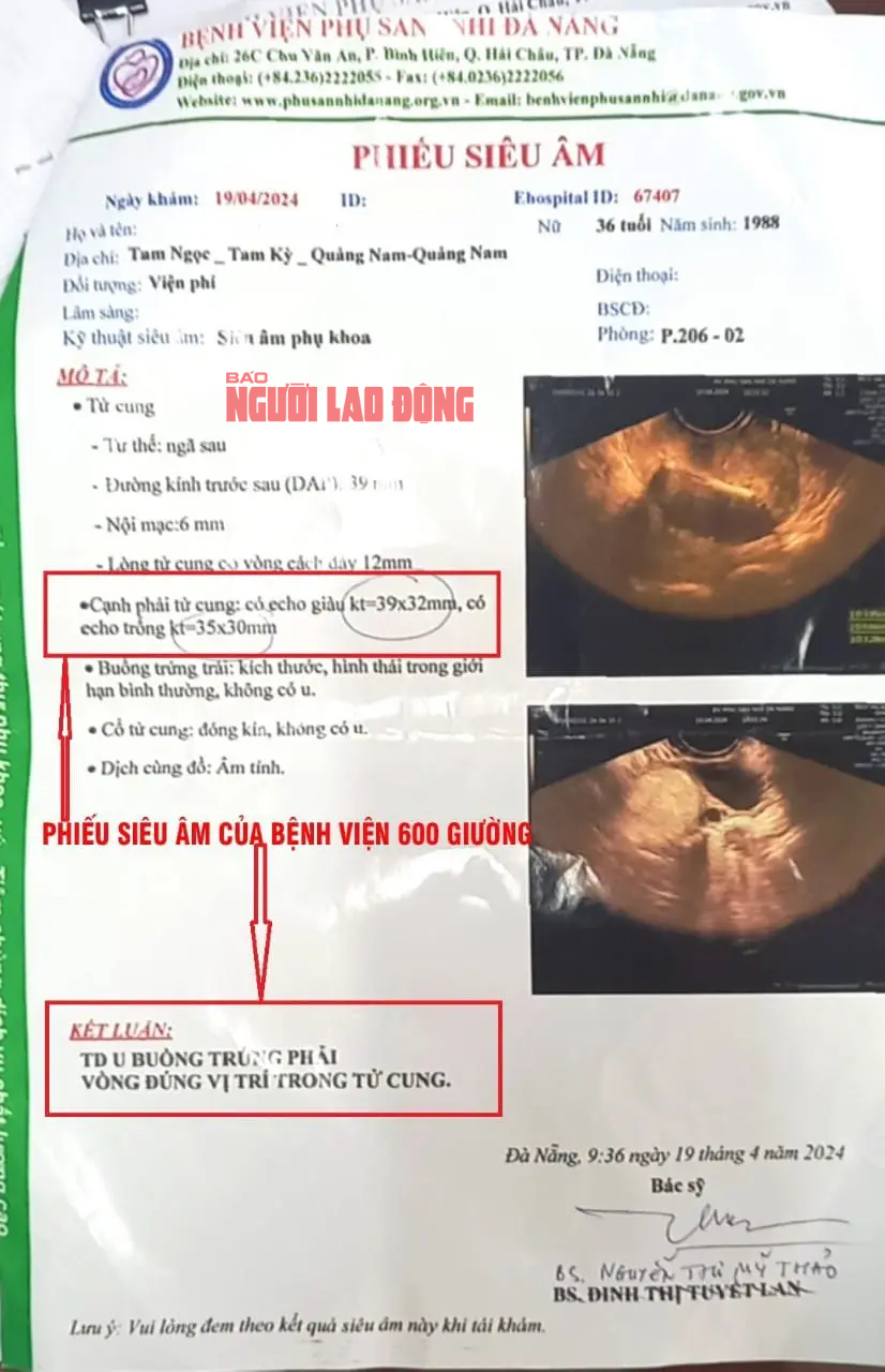BV Đa khoa Quảng Nam: Siêu âm u nang buồng trứng phải, phẫu thuật buồng trứng trái?- Ảnh 2.