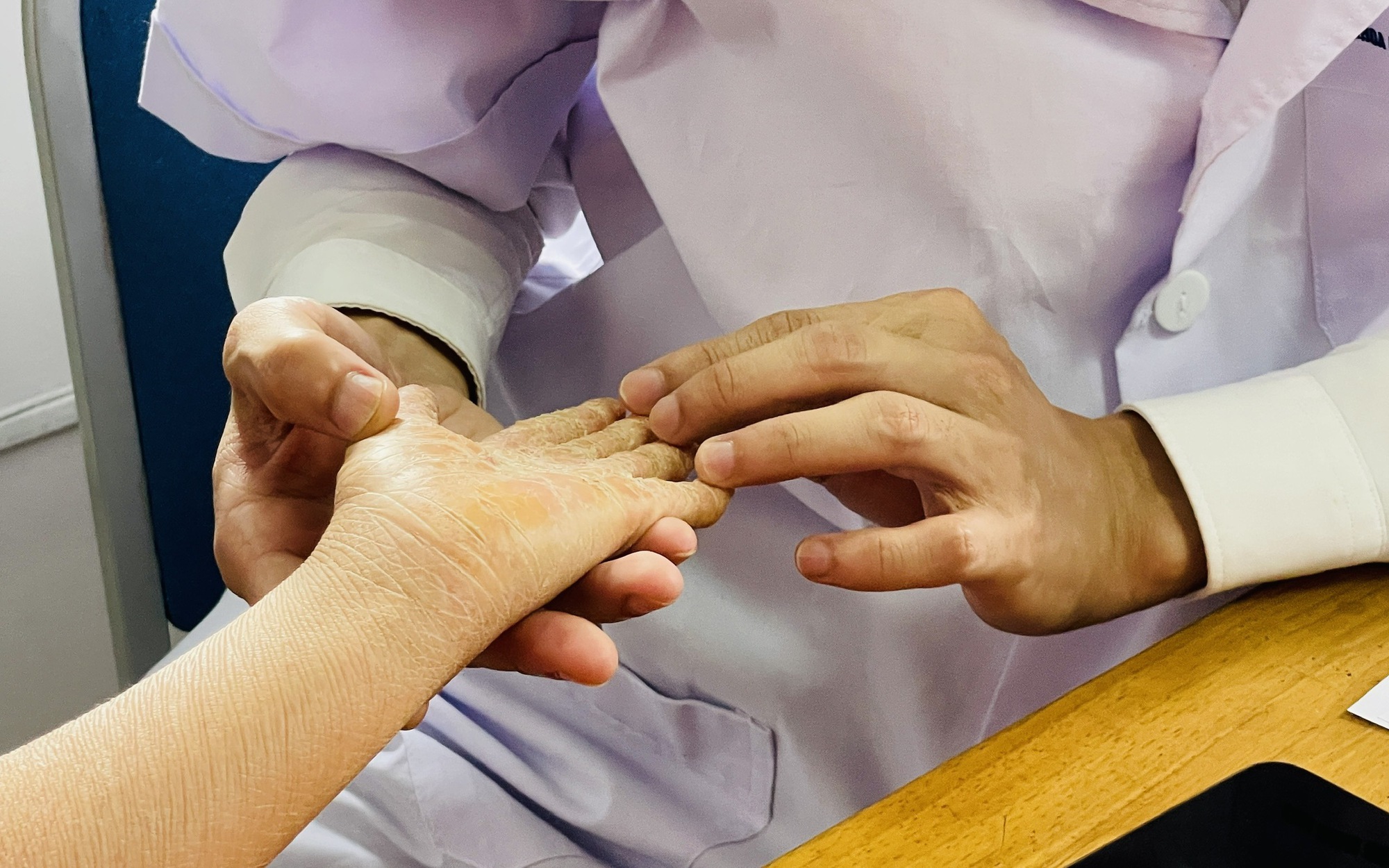 Điều trị bệnh vảy nến ở tuyến tỉnh được chi trả như trung ương