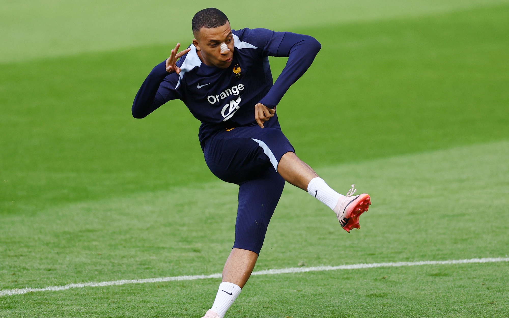 EURO 2024: Ấn định ngày Mbappe phẫu thuật chấn thương mũi