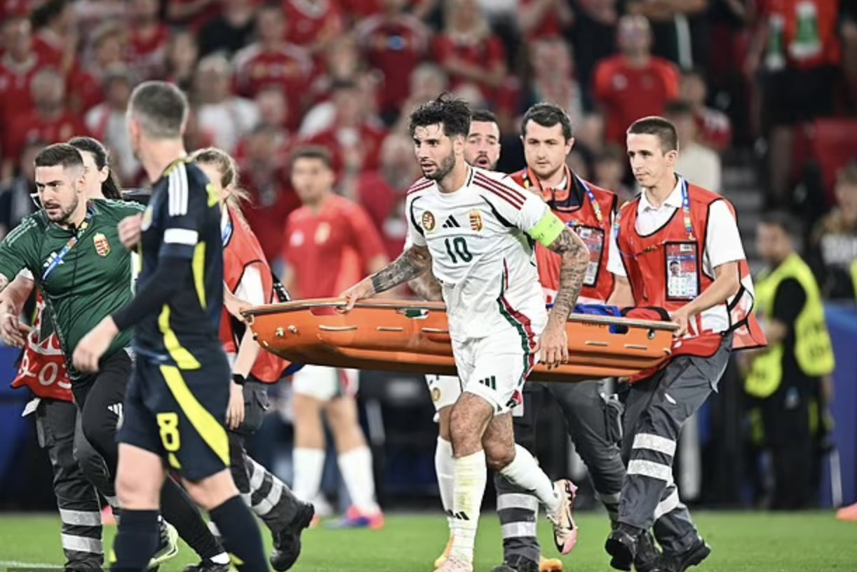 Euro 2024: Sau chấn thương kinh ho&agrave;ng ở mặt, tuyển thủ Hungary giờ ra sao?- Ảnh 3.