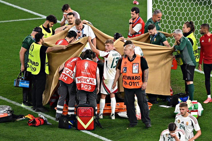 Euro 2024: Sau chấn thương kinh ho&agrave;ng ở mặt, tuyển thủ Hungary giờ ra sao?- Ảnh 2.