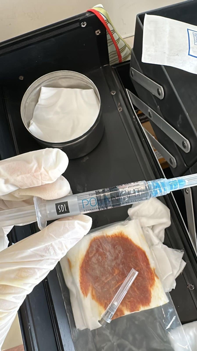 Ống gel &ocirc;xy gi&agrave; tẩy trắng răng song được d&ugrave;ng ti&ecirc;m v&agrave;o mắt kh&aacute;ch h&agrave;ng