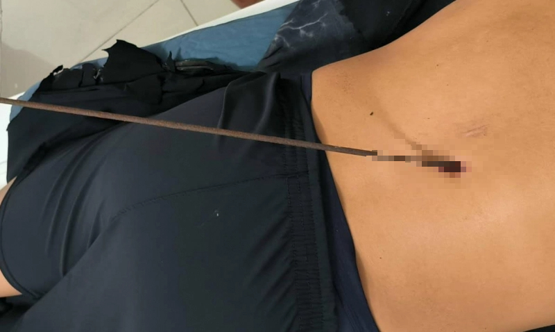 Đi săn cá dưới biển, 1 người bị mũi tên đâm xuyên phổi- Ảnh 1.