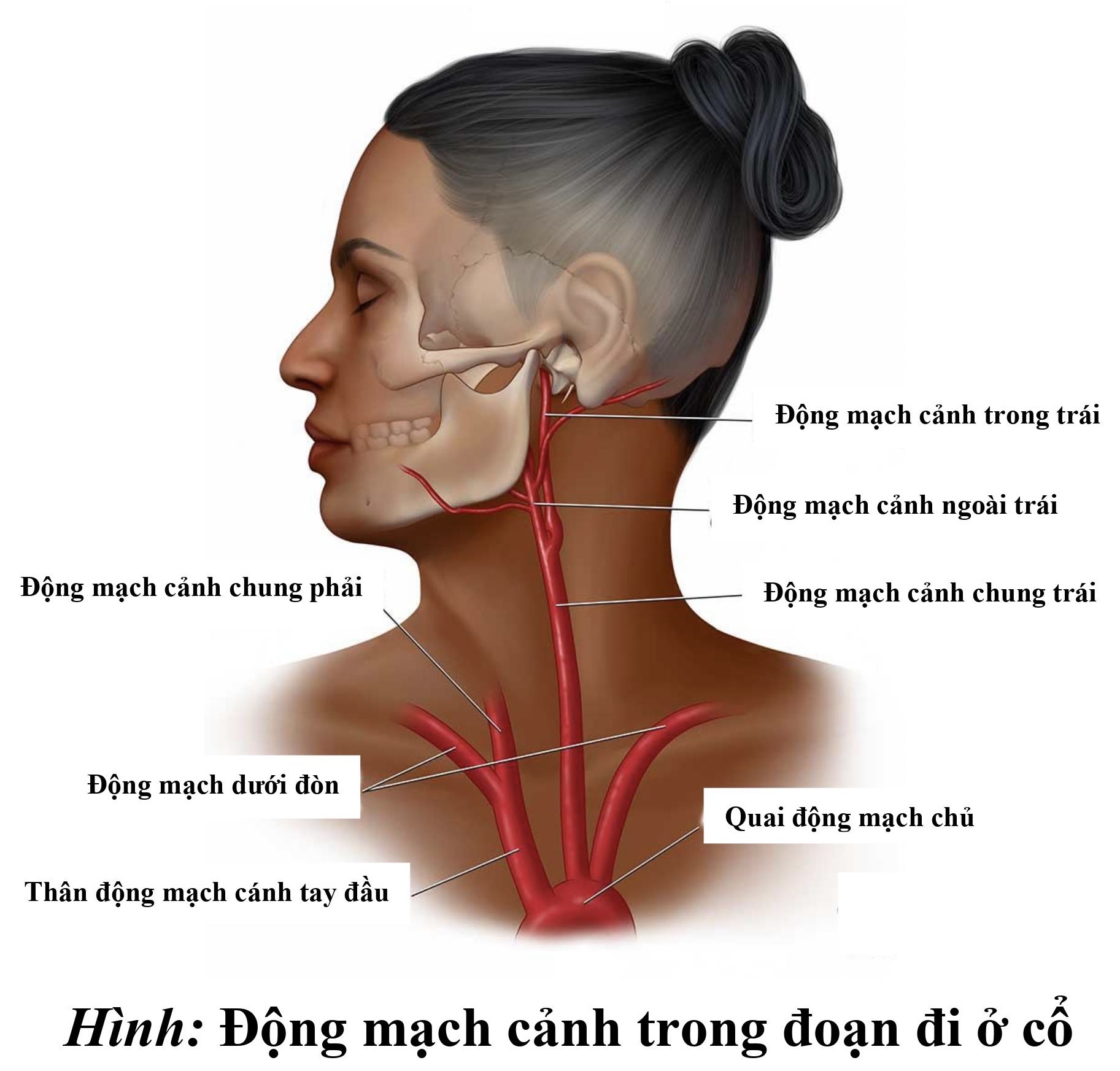 Người đ&agrave;n &ocirc;ng đột quỵ sau khi gi&aacute;c hơi tại nh&agrave;- Ảnh 3.