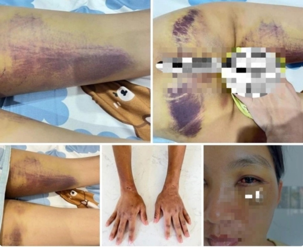 Một phụ nữ bị gia đ&igrave;nh chồng cũ h&agrave;nh hạ d&atilde; man để... trừ t&agrave;!- Ảnh 2.