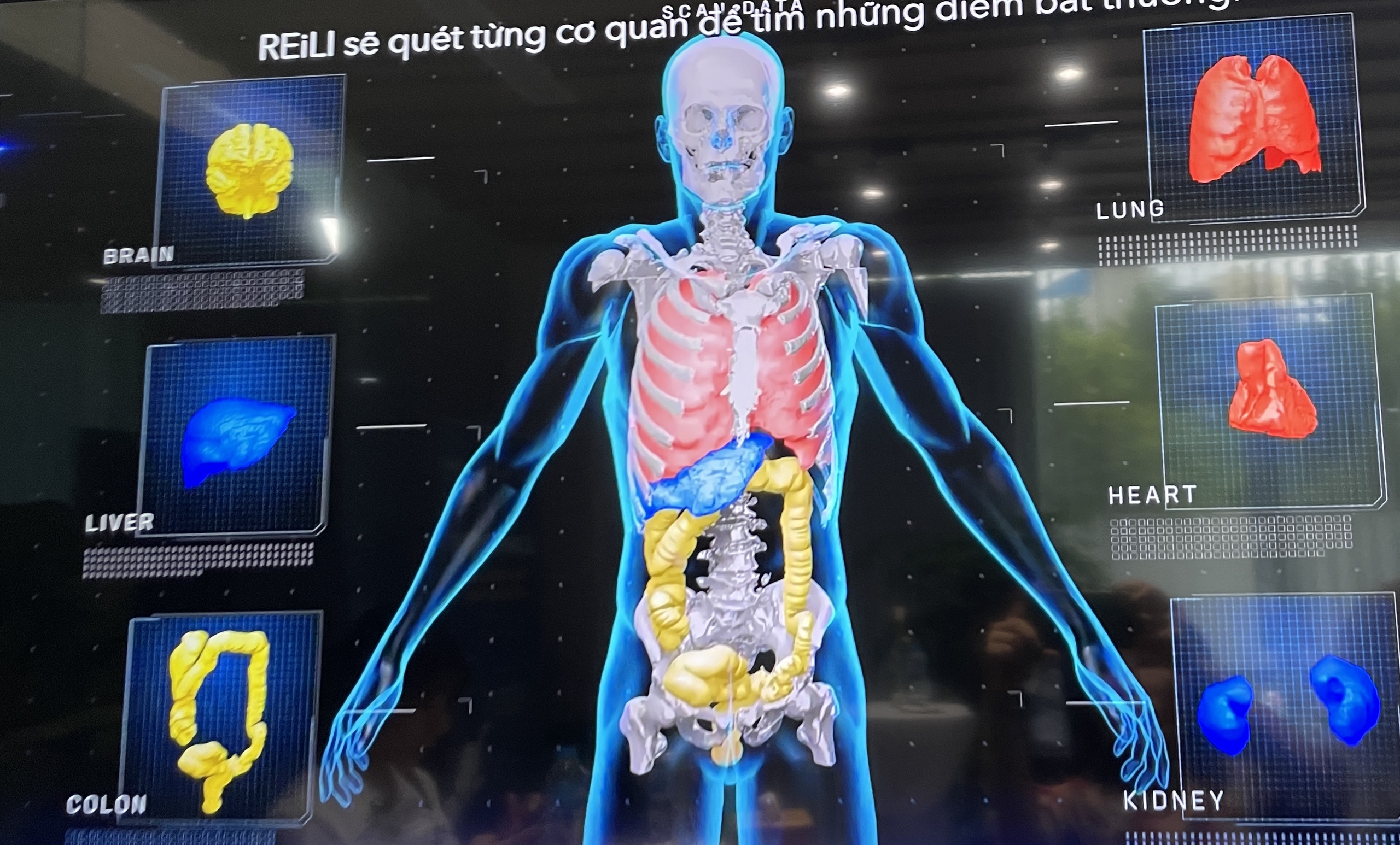 Trung t&acirc;m tầm so&aacute;t ung thư bằng AI đầu ti&ecirc;n tại Việt Nam- Ảnh 2.