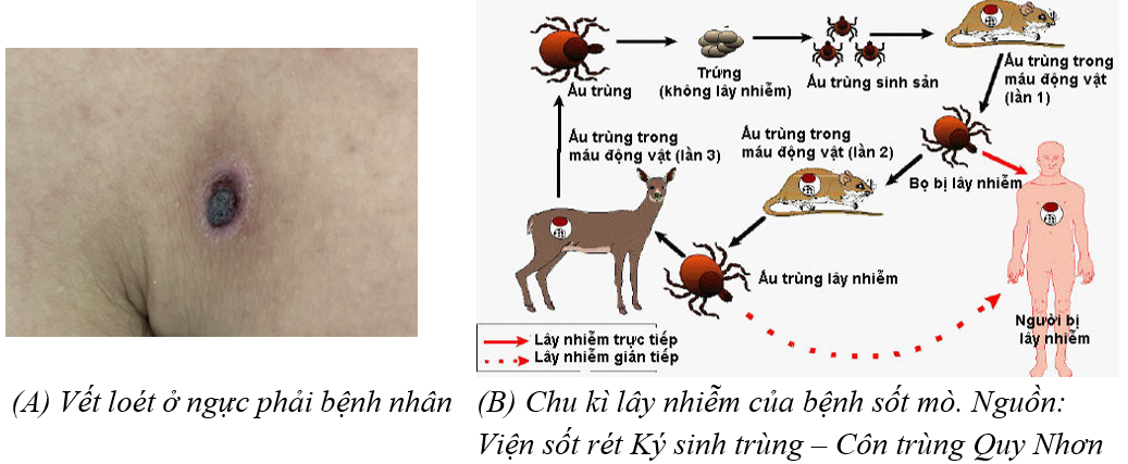Nguy kịch do mò đốt- Ảnh 2.