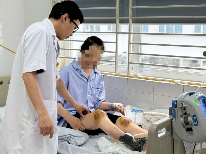 Chữa bệnh bằng ong đốt, người phụ nữ bị hoại tử chân- Ảnh 1.