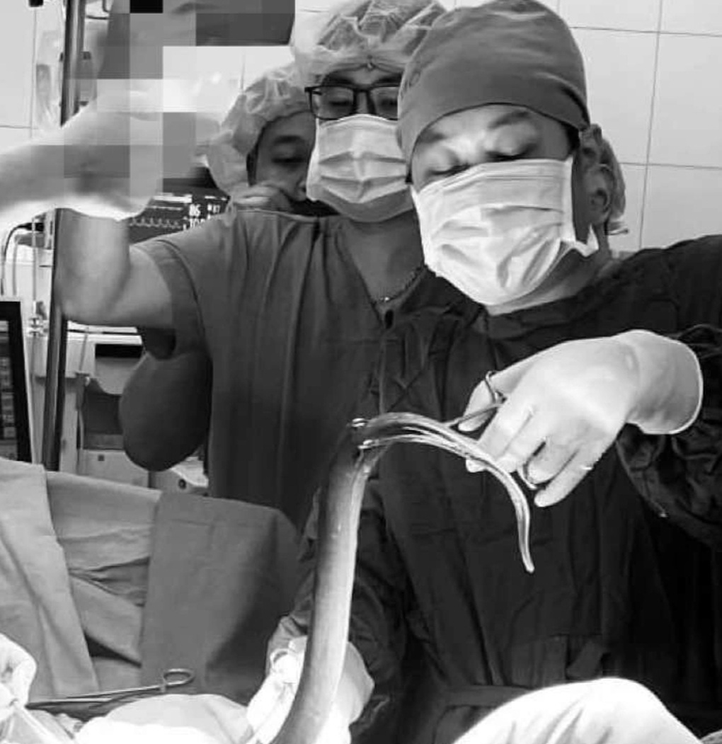 Nh&eacute;t con lươn v&agrave;o hậu m&ocirc;n, bị cắn thủng trực tr&agrave;ng- Ảnh 1.