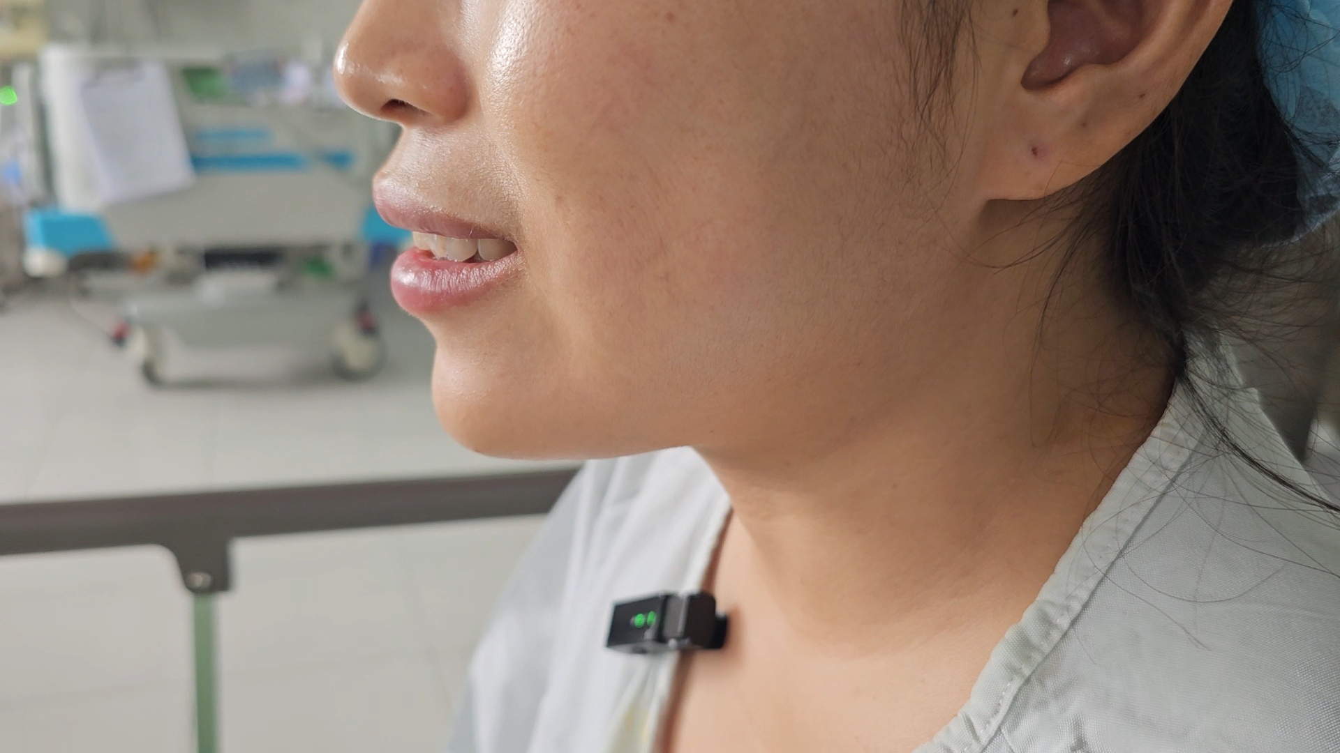Người phụ nữ gặp nạn sau 5 năm phẫu thuật tạo má lúm đồng tiền- Ảnh 4.