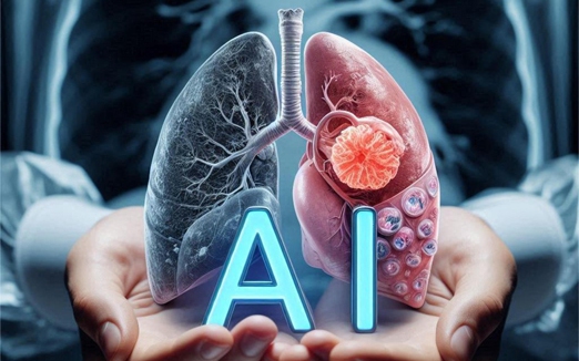 Công cụ AI mới nâng cao chất lượng điều trị ung thư