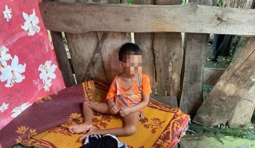 B&eacute; 5 tuổi bị "bỏ rơi" trong l&aacute;n tạm với nhiều vết thương, lở lo&eacute;t- Ảnh 1.